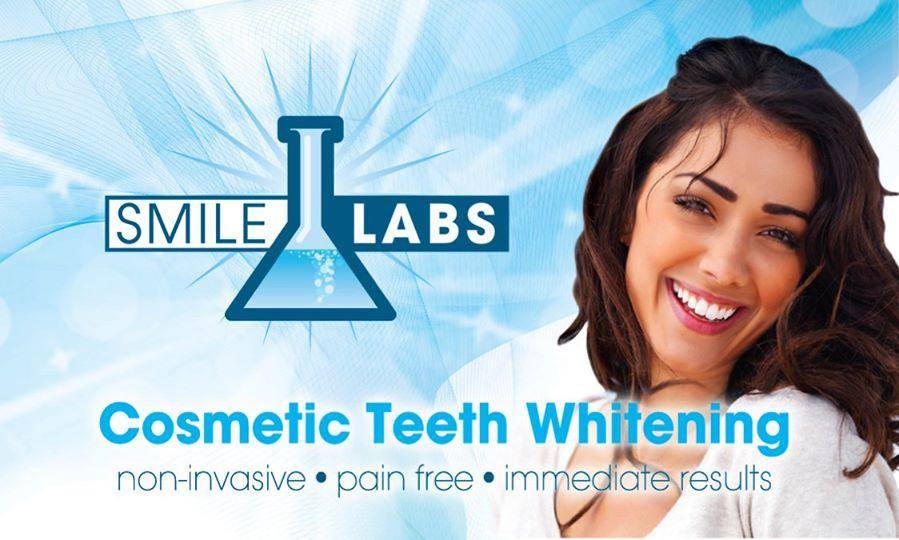 Smile Labs Teeth Whitening